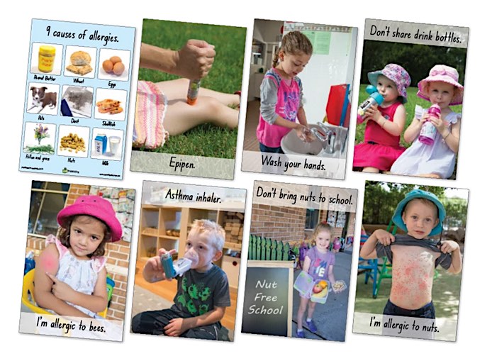 Allergies Posters Set of 8