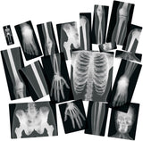 True to Life Human X-Rays 18pcs