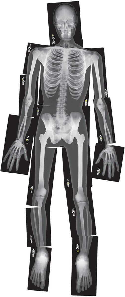 True to Life Human X-Rays 18pcs